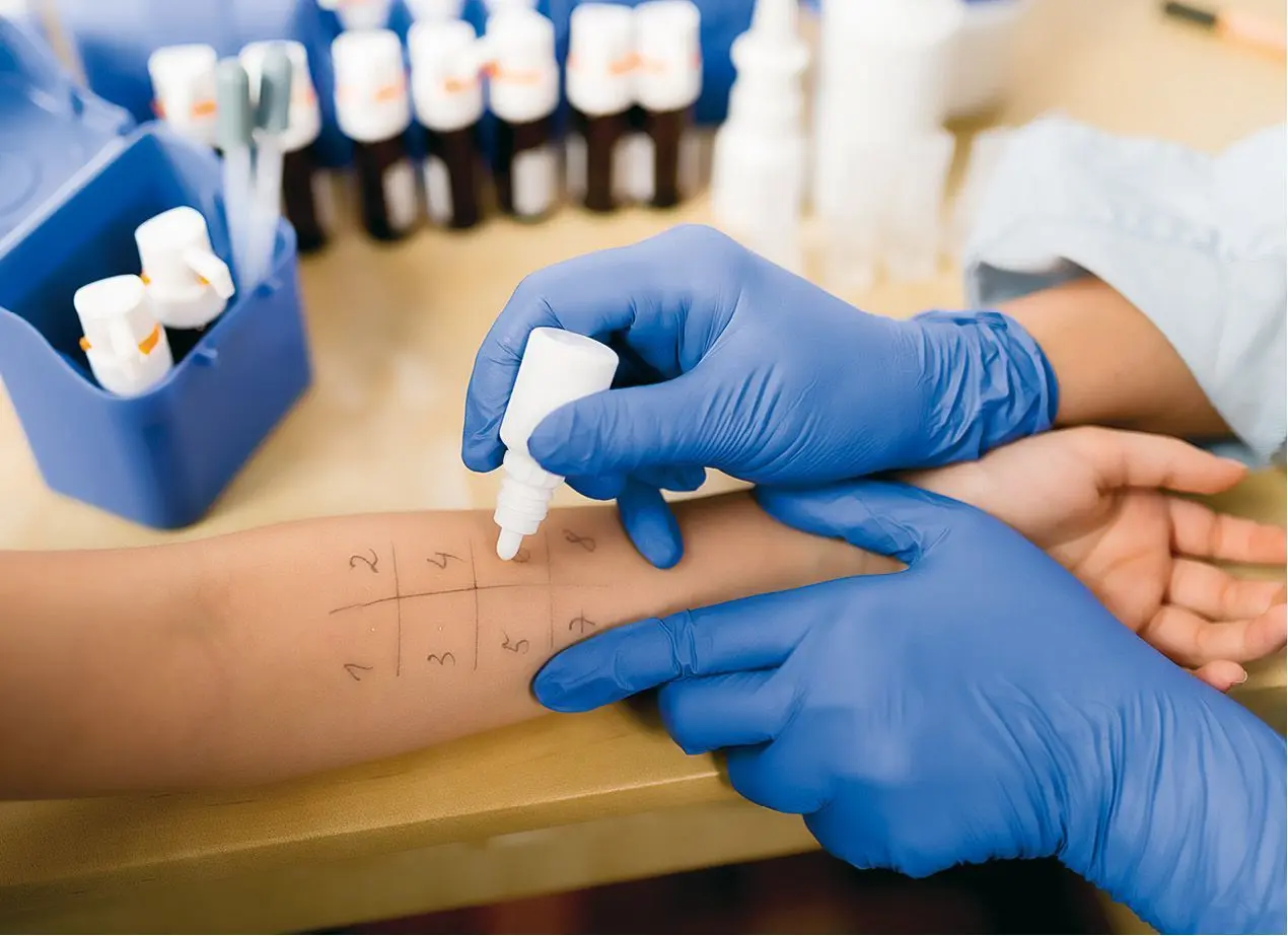 Para confirmar la sospecha clínica en las reacciones alérgicas a medicamentos existen distintos tipos de pruebas cutáneas y pruebas de exposición controlada.