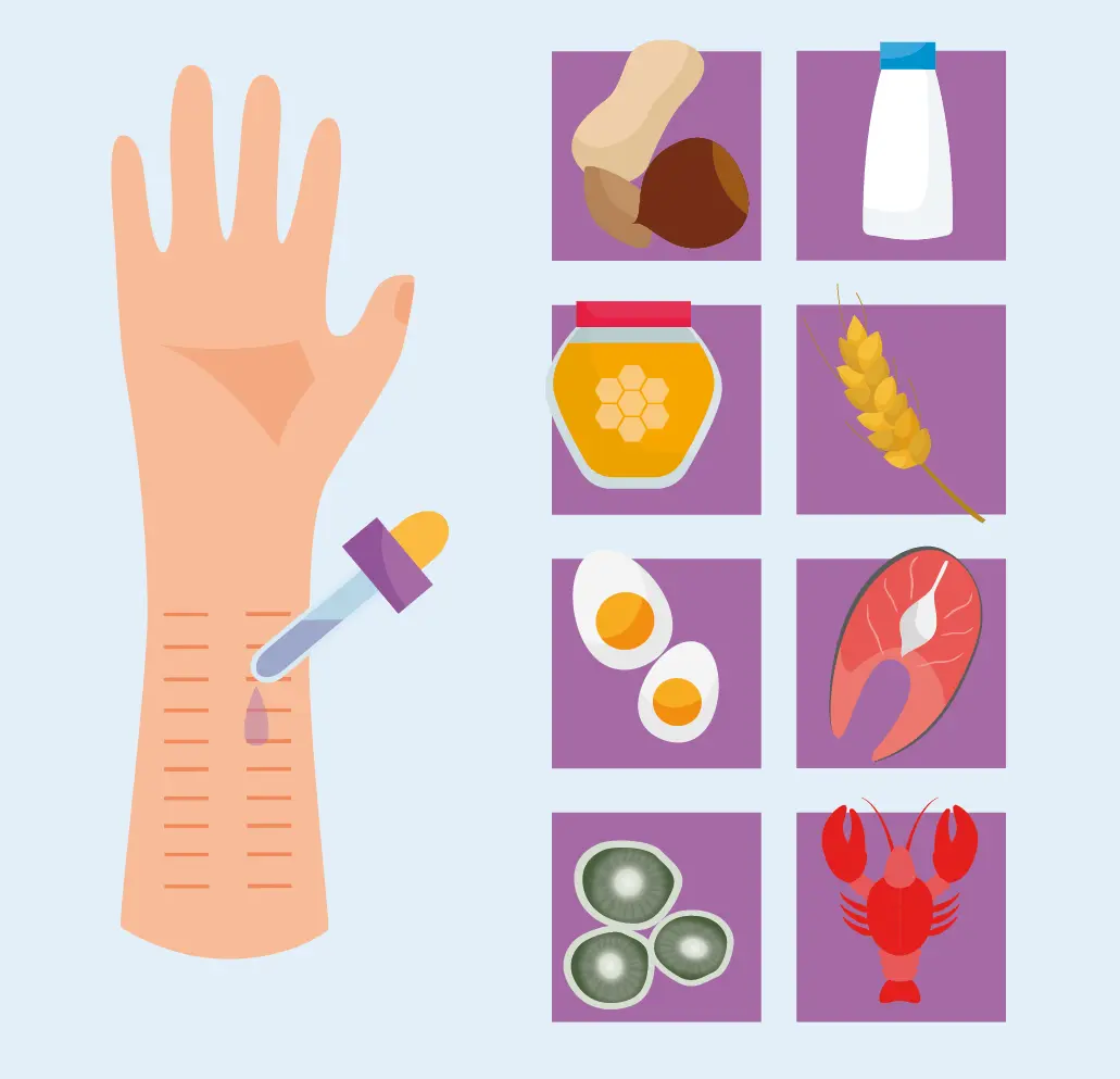 Figura 3. Las pruebas de alergia, en piel o en sangre, no pueden determinar por sí solas cuál es el alimento que causa la esofagitis eosinofílica