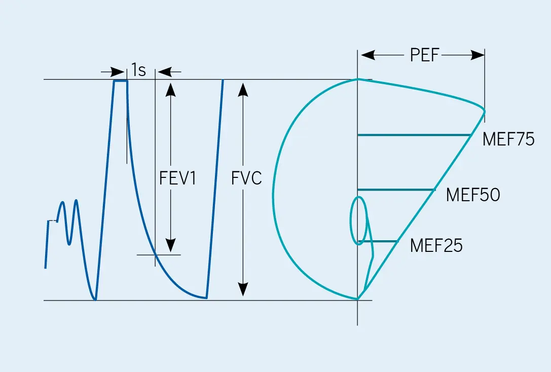 Figura 2. Representaciones gráficas de la espirometría: volumen/tiempo (derecha) y flujo/volumen (izquierda)