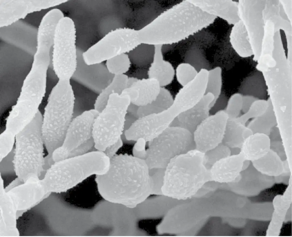 Figura 3. Esporas de Cladosporium herbarum. Microscopía electrónica de barrido (x 2.265 aumentos)