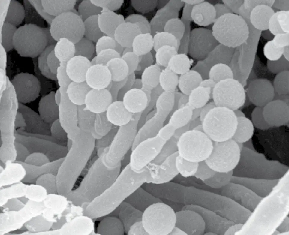 Figura 4. Esporas de Penicillium. Microscopia electrónica de barrido (x 3.610 aumentos)