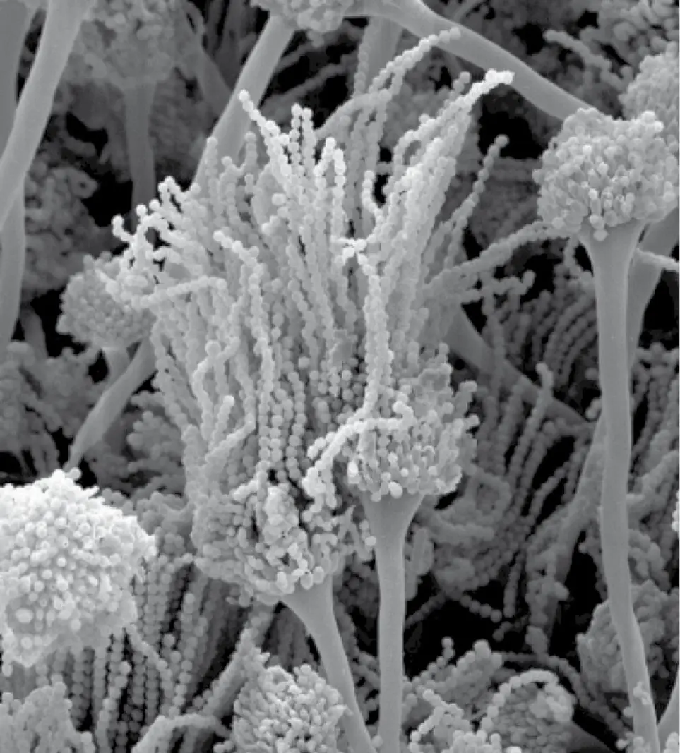 Figura 5. Esporas de Aspergillus fumigatus. Microscopia electrónica de barrido (x 1.200 aumentos)